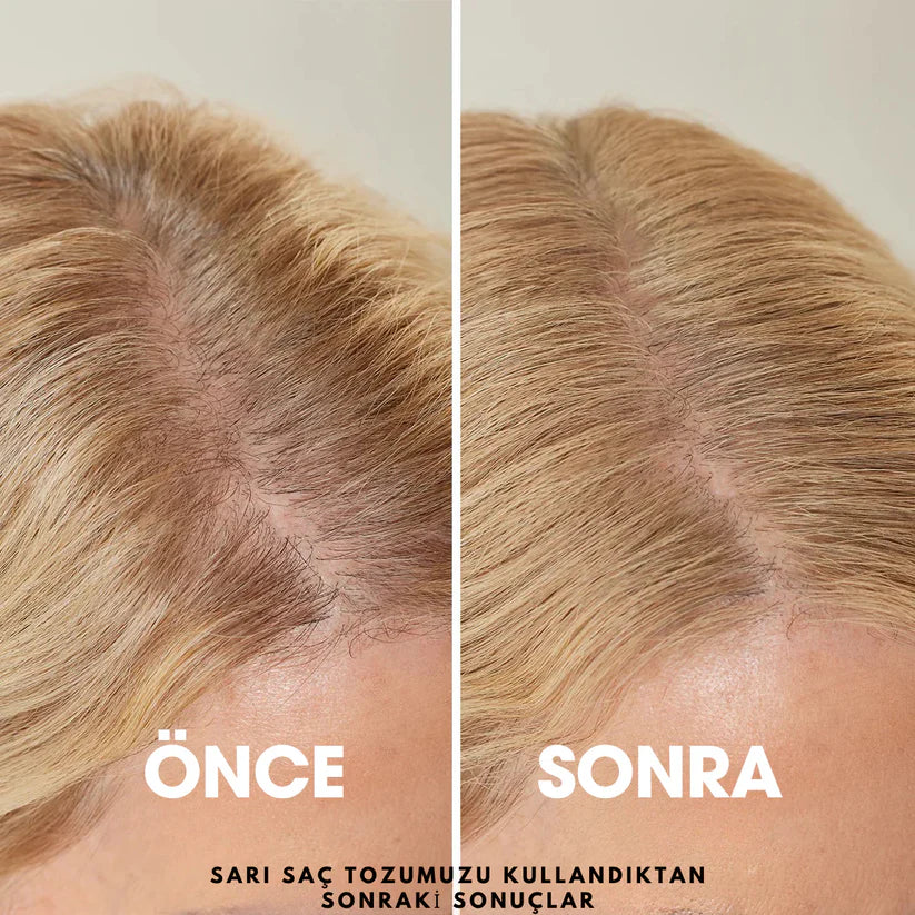 Tarneda Regenesis Saç Yoğunluğu Dolgusu